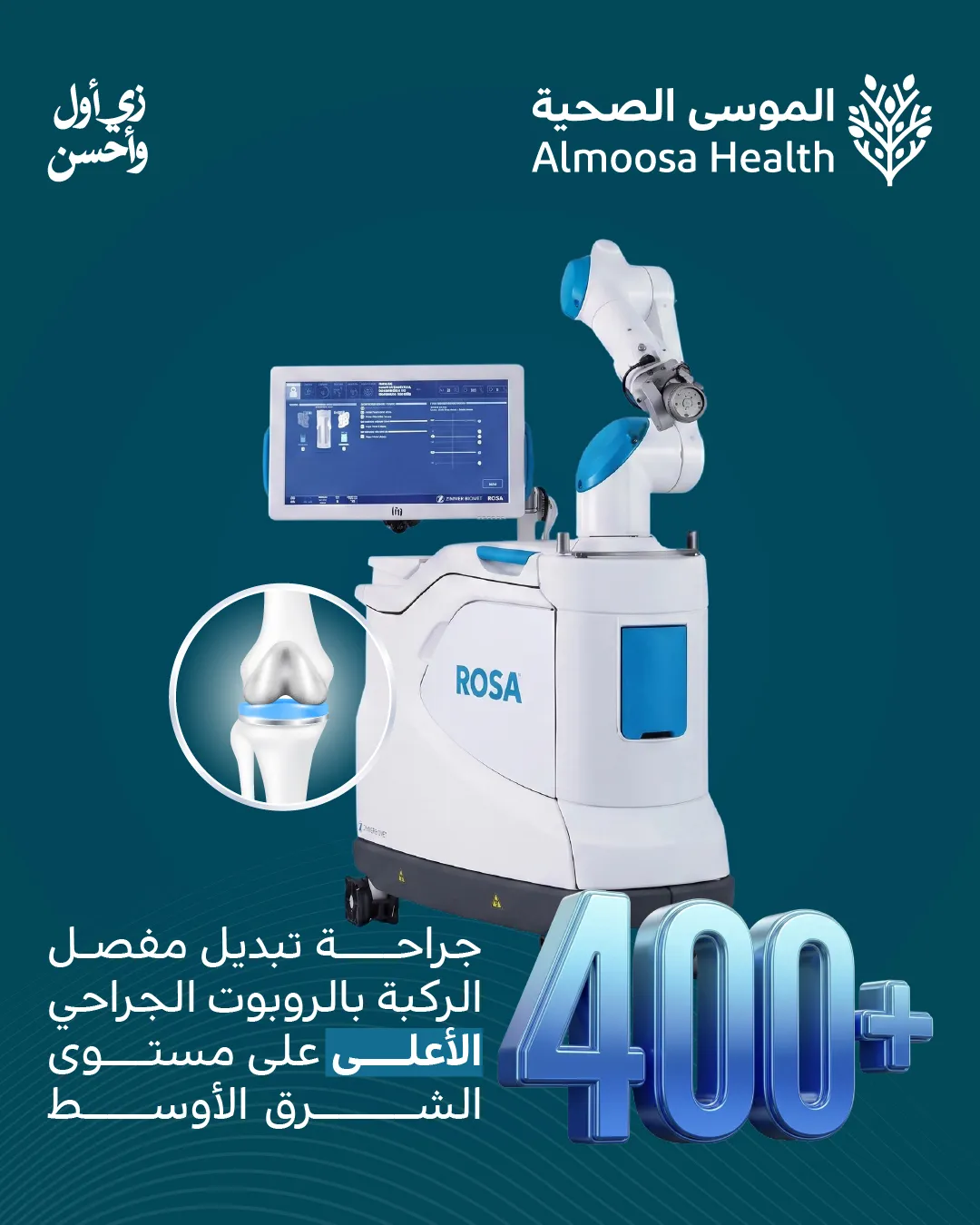 الروبوت الجراحي ROSA - 400+ عملية ناجحة